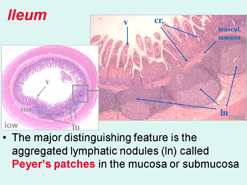 The major distinguishing feature is the aggregated lymphatic nodules (ln) called Peyer’s patches in